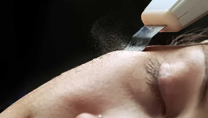فیشیال پوست بر روی صورت زن با دستگاه التراسونیک